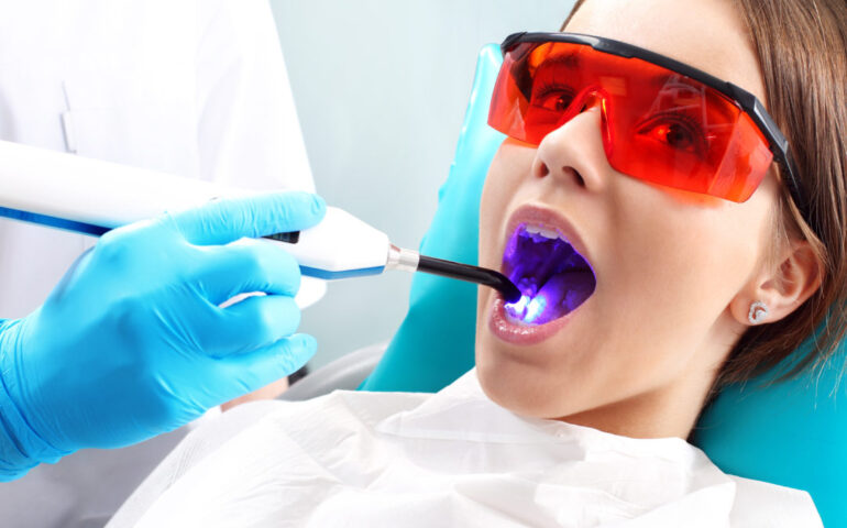 laser-dentistry-1080x675